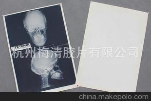 MPET 醫(yī)用X光膠片圖片