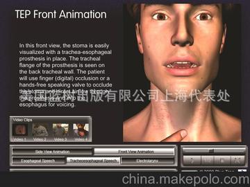 供應(yīng)“喉頭切除-電子喉”教育軟件- 英文版